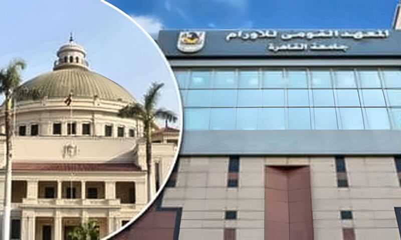 جراحة روبوتية لاستئصال الغدة التيموسية بمعهد الأورام والمريض يغادر بعد 48 ساعة