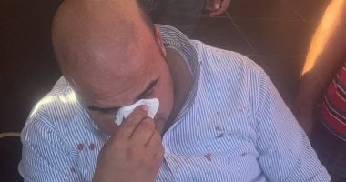 كسر فى الأنف.. التعدى على نائب رئيس مدينة رأس البر أثناء حملة إشغالات