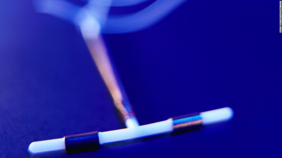 Do you know what an IUD is? Many don’t