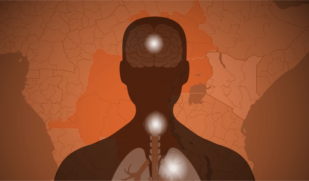 Tracking the Ebola outbreak: Where the deadly virus is spreading
