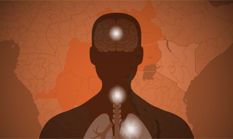 Tracking the Ebola outbreak: Where the deadly virus is spreading