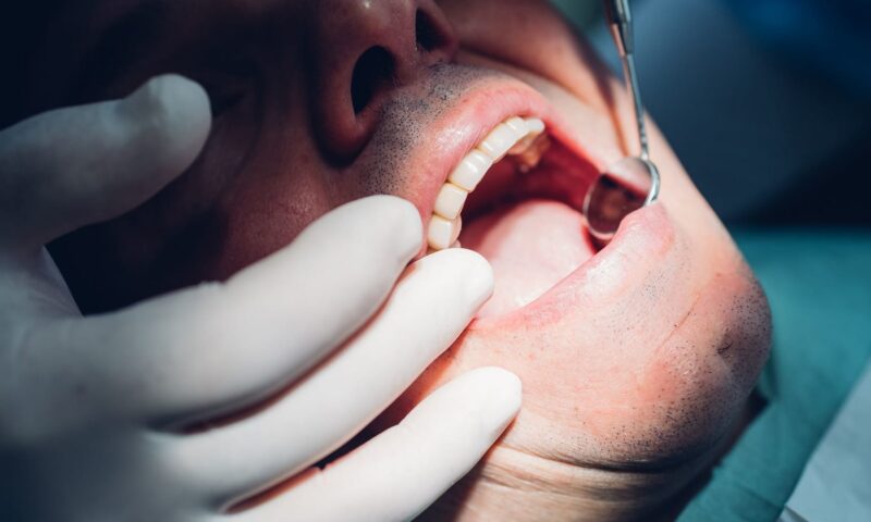 التهاب ضرس العقل..9 أعراض تنذر بهذه الحالة