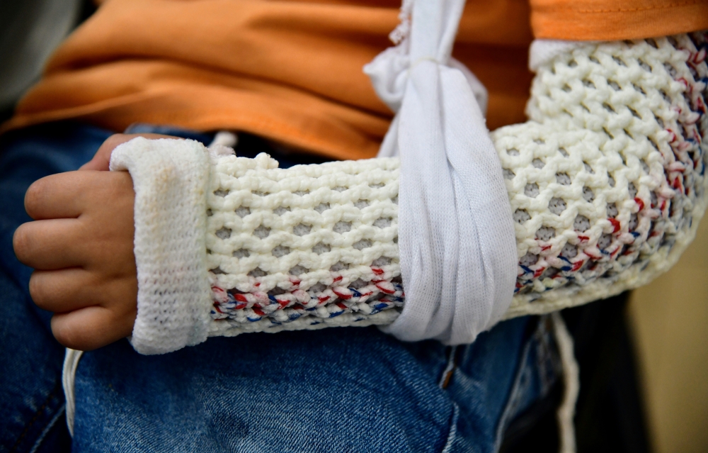 Mum claims primary school bullies broke son’s arm, Kedah Education Dept investigating