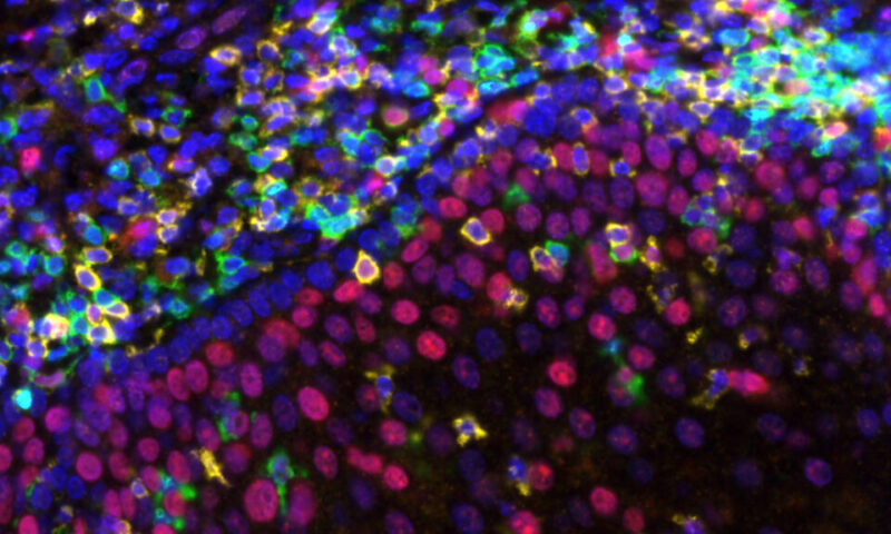Ultra-low doses could bring costly cancer treatments to more patients in poorer countries