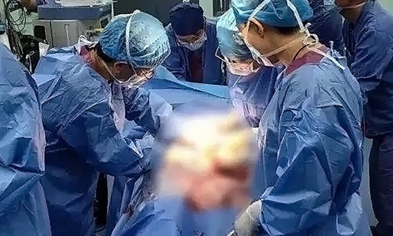 ‘Save her first’: China expectant mum relinquishes surgery room slot to bleeding pregnant woman