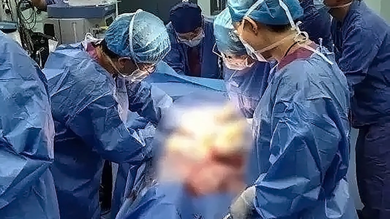 ‘Save her first’: China expectant mum relinquishes surgery room slot to bleeding pregnant woman