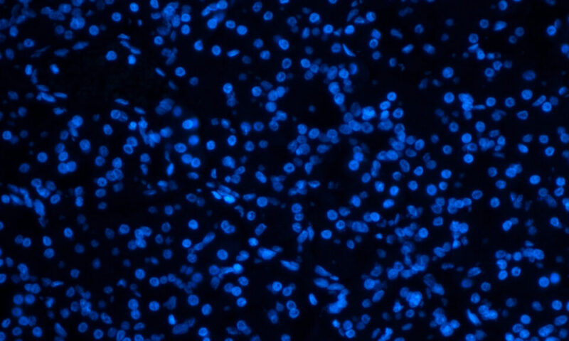 STAT+: Ahead of ASCO, all eyes on pancreatic cancer