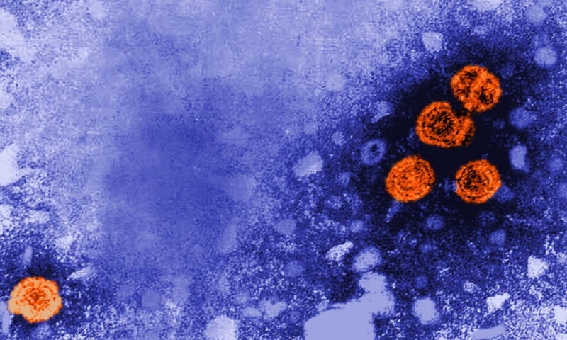 STAT+: Experimental hepatitis B treatment was a ‘functional cure’ for nearly 1 in 5, new data show