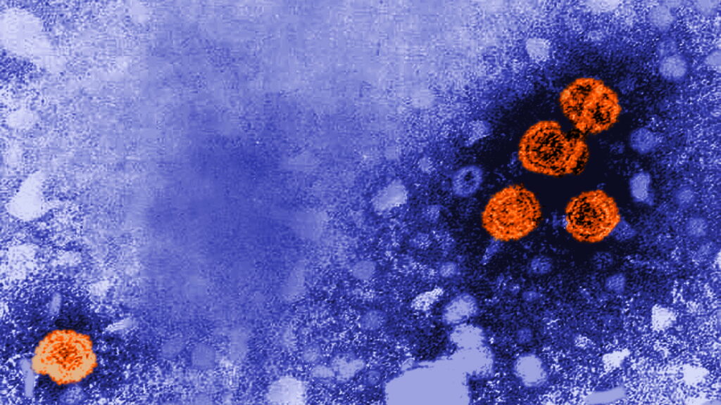 STAT+: Experimental hepatitis B treatment was a ‘functional cure’ for nearly 1 in 5, new data show