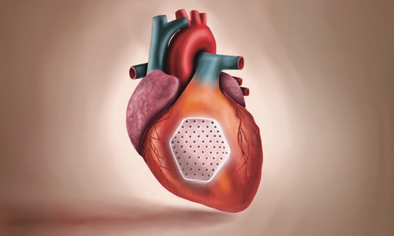 STAT+: Heart patch engineered from stem cells revved up weakened hearts