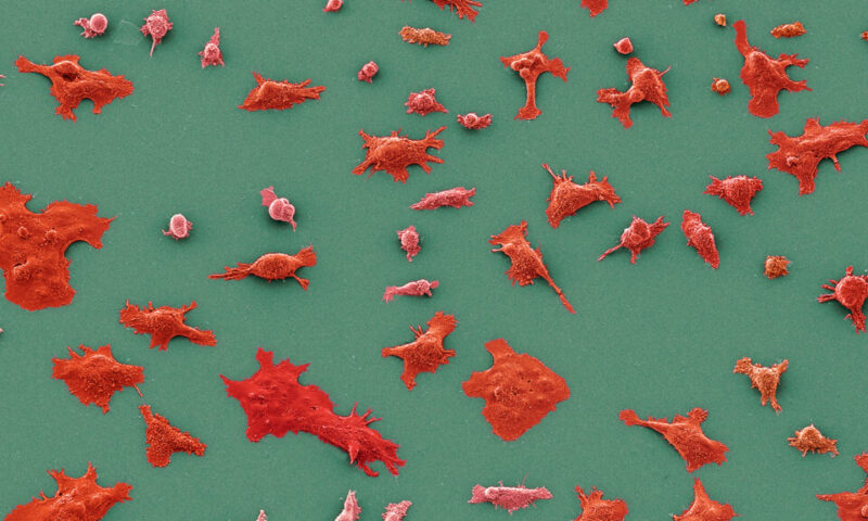 STAT+: Practice-changing results reported for Revolution Medicines pancreatic cancer drug