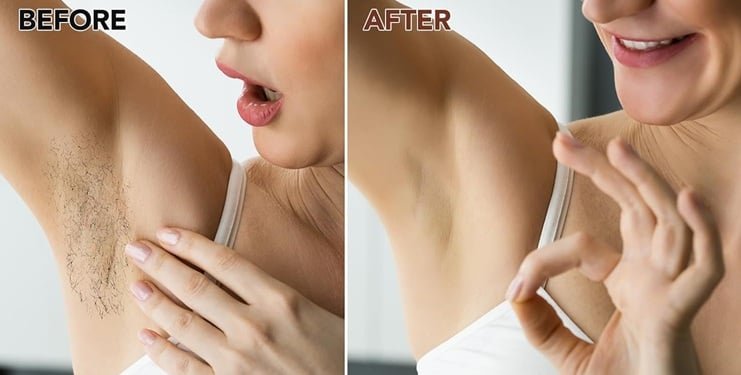 More than 700 Amazon shoppers have already spotted this under-£10 hair removal beauty product (aff)