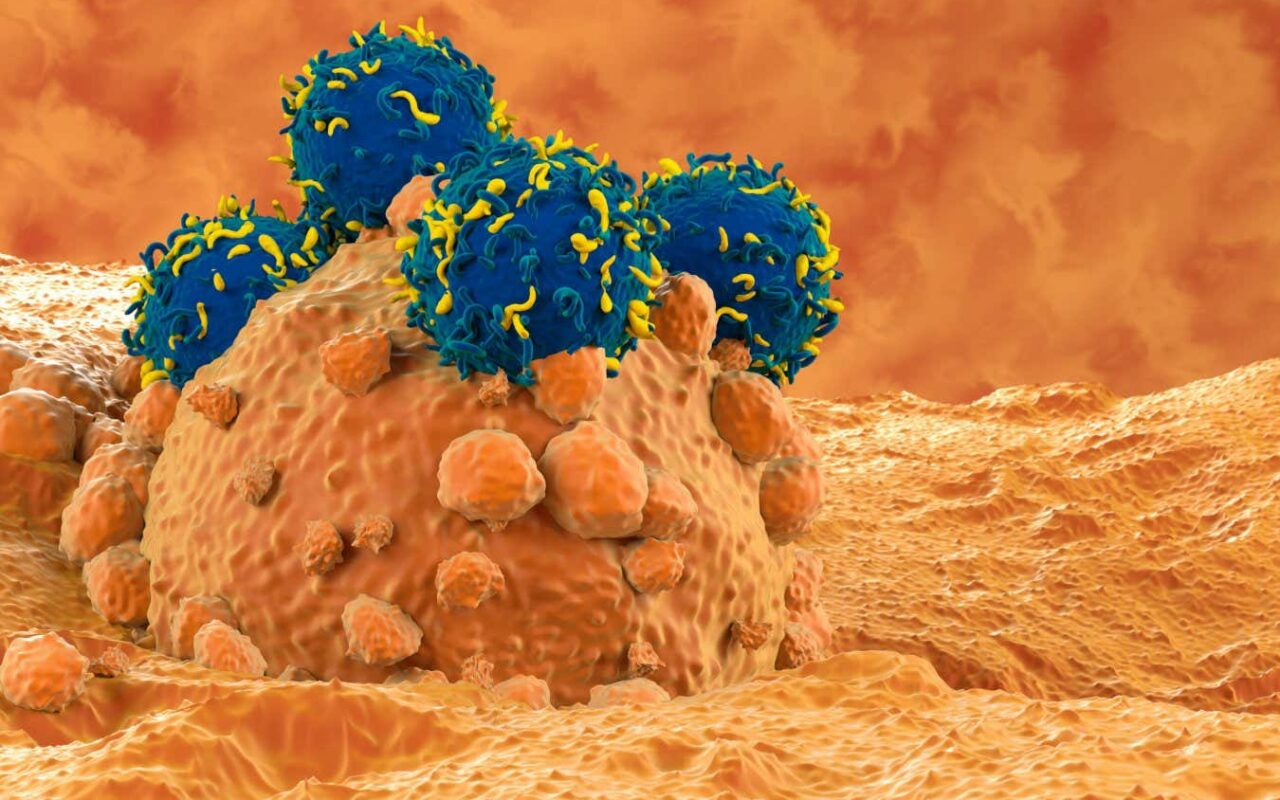 CAR T-cell therapy bolstered by stiffening up cancer cells first