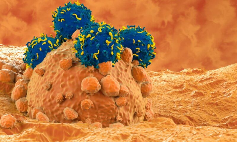 CAR T-cell therapy bolstered by stiffening up cancer cells first