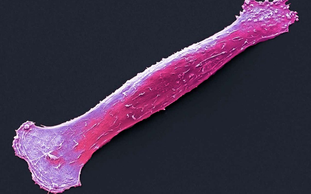 Rebooting stem cells builds aged muscles and assists injury recovery