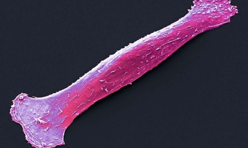 Rebooting stem cells builds aged muscles and assists injury recovery