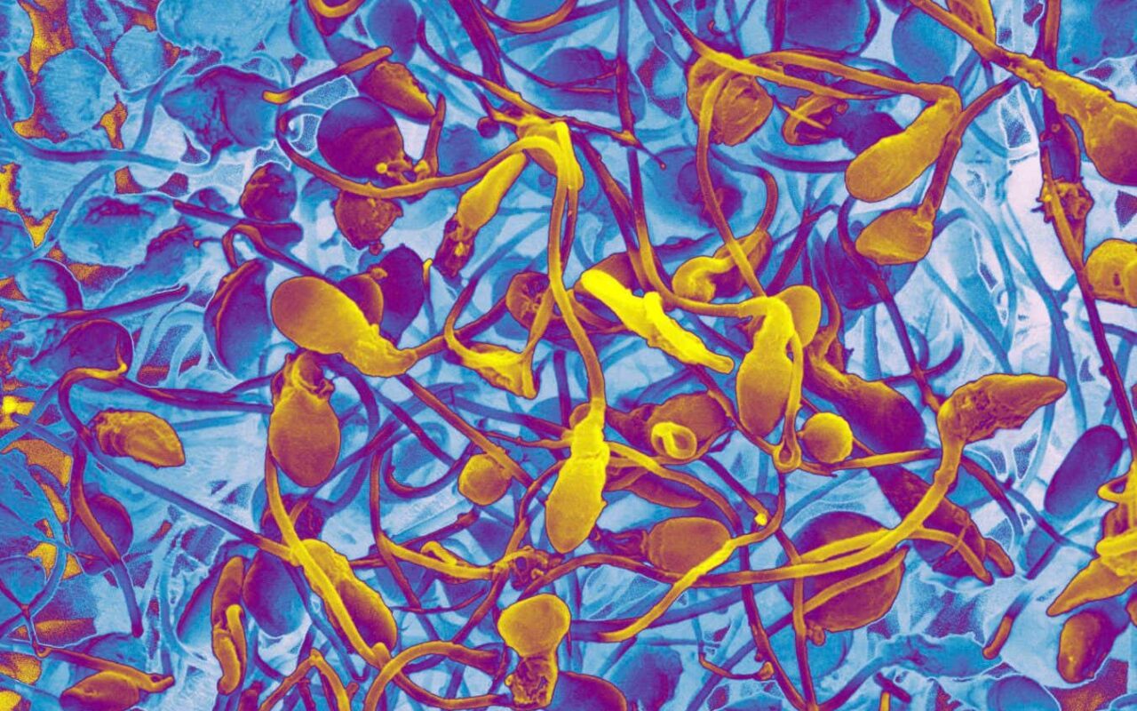 Will lab-grown sperm let infertile men have children of their own?