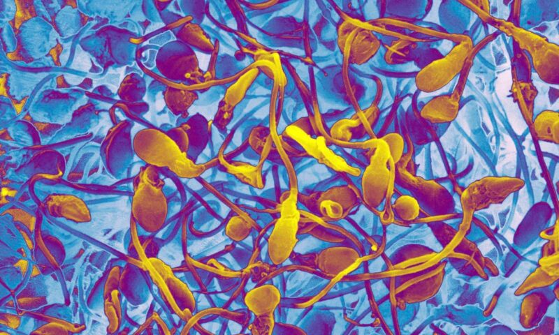Will lab-grown sperm let infertile men have children of their own?