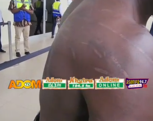 “I suffered beatings, look at my marks” – Evacuated Ghanaian recounts alleged xenophobic attack in South Africa