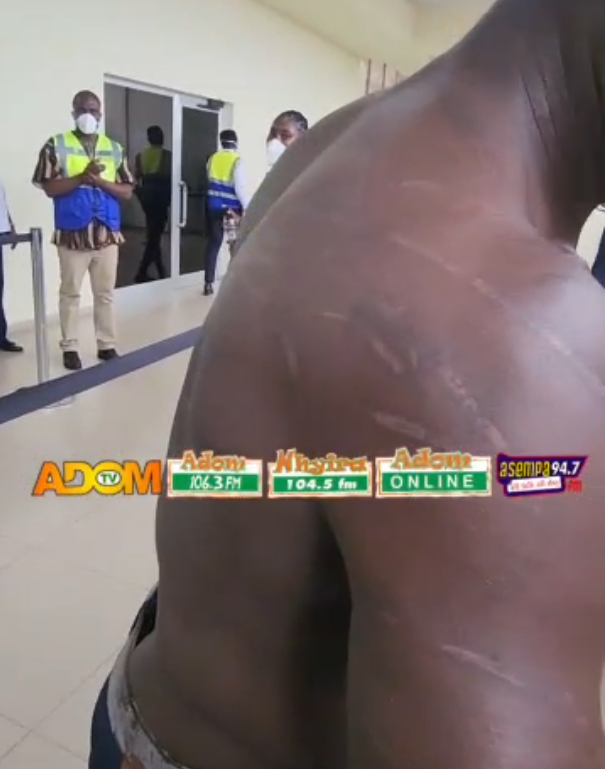“I suffered beatings, look at my marks” – Evacuated Ghanaian recounts alleged xenophobic attack in South Africa