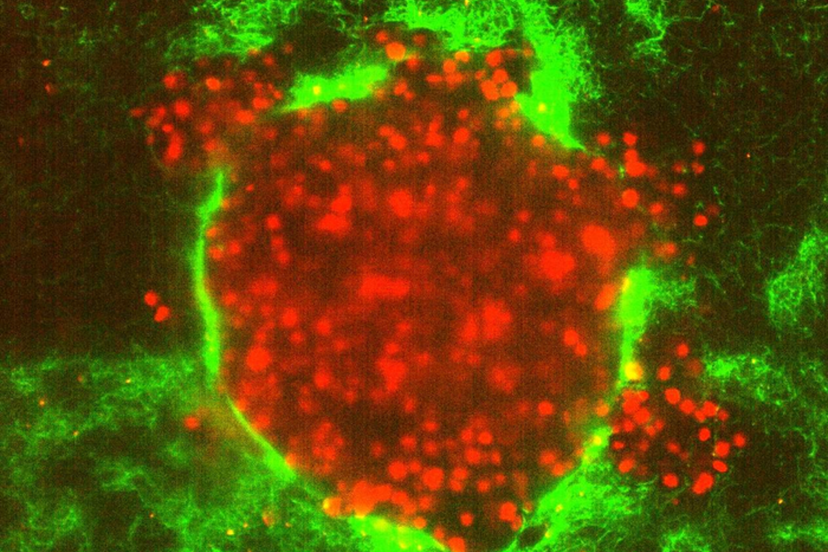 Studies reveal why some cancers are so much more dangerous than others