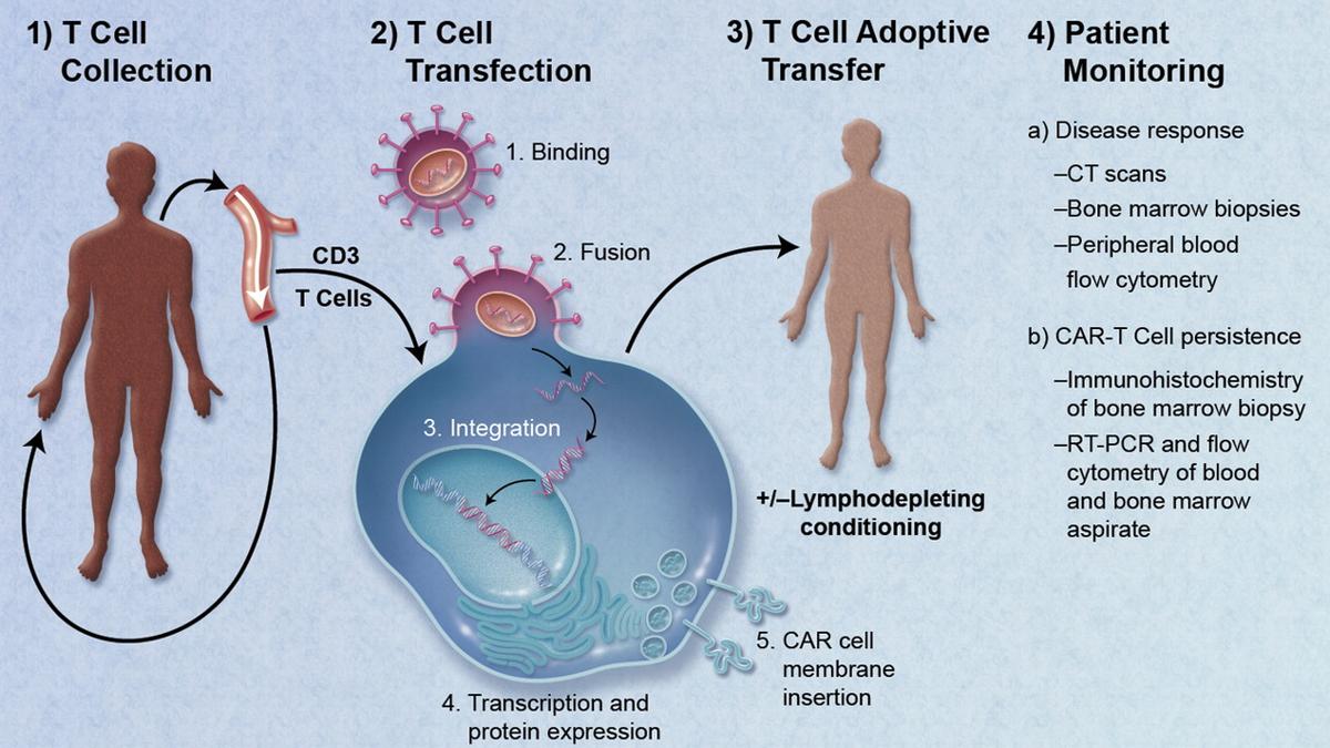 Understanding the potential of CAR-T therapy in autoimmune disease treatment