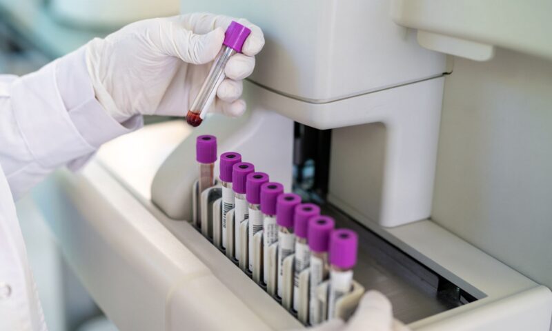 Blood test could detect Alzheimer’s signs ‘decades before symptoms appear’