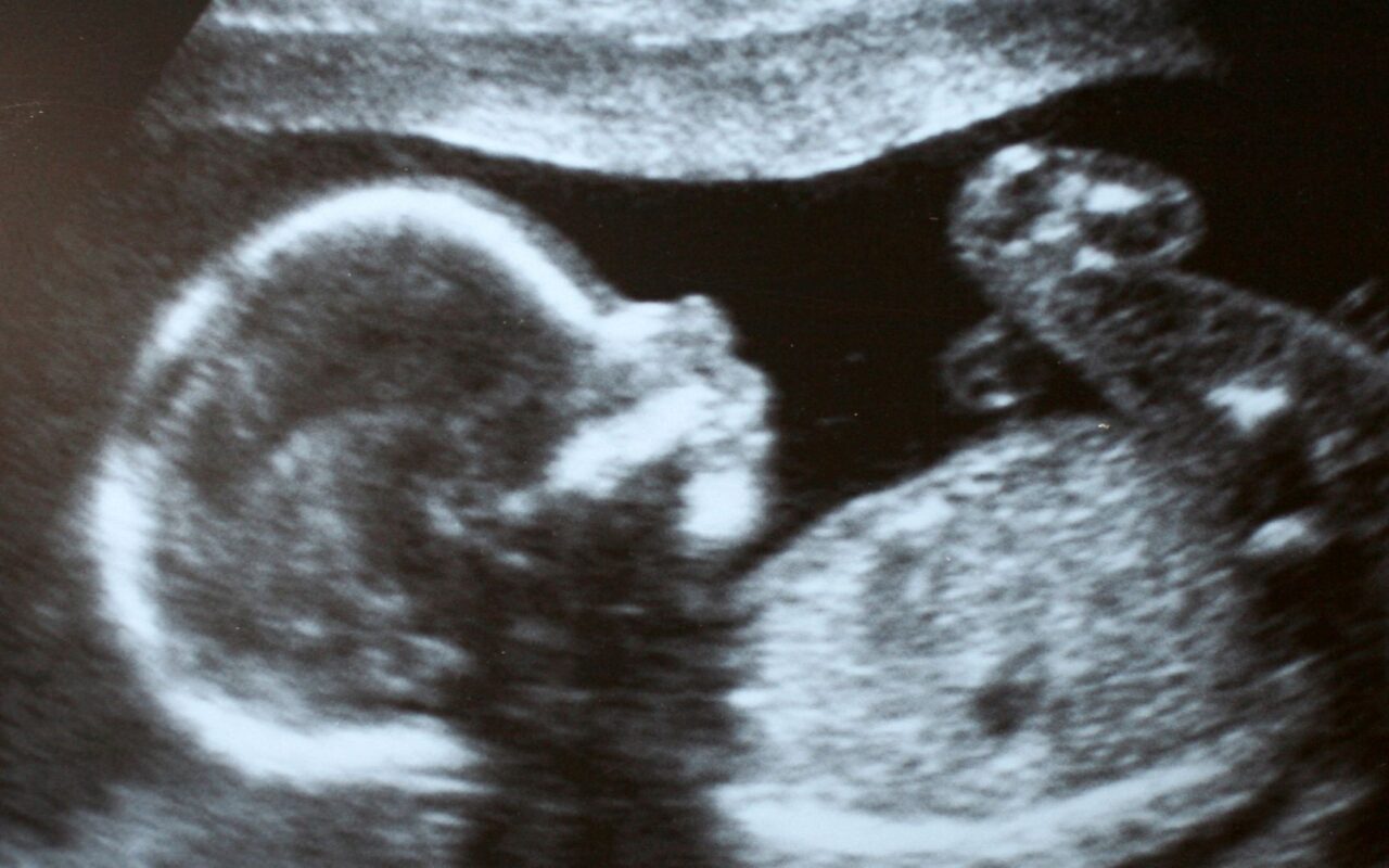 Inside UK’s maternity crisis: What it’s really like to give birth