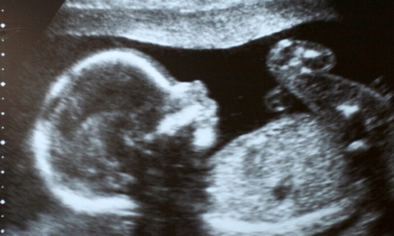Inside UK’s maternity crisis: What it’s really like to give birth