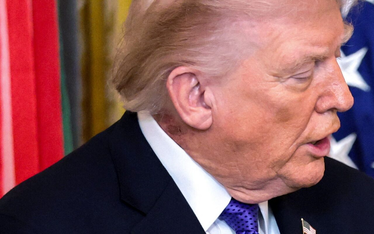 Trump says health check ‘perfect’ after scrutiny over rash