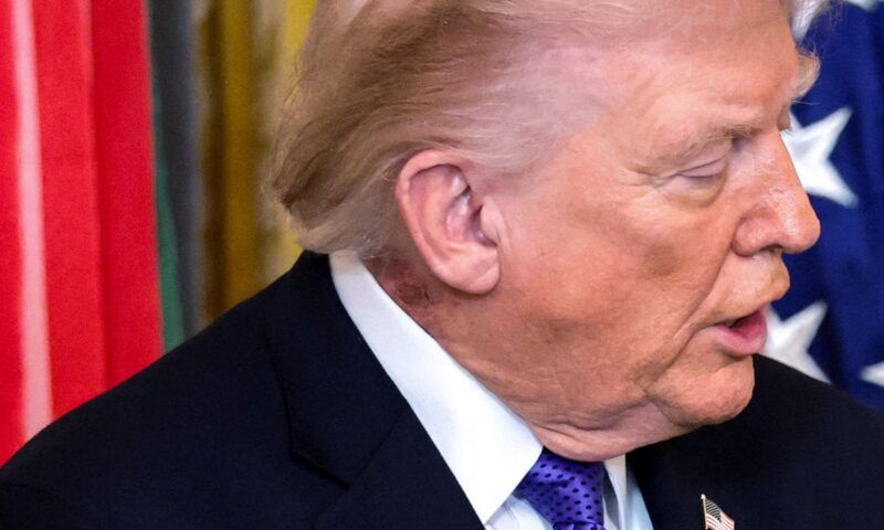 Trump says health check ‘perfect’ after scrutiny over rash