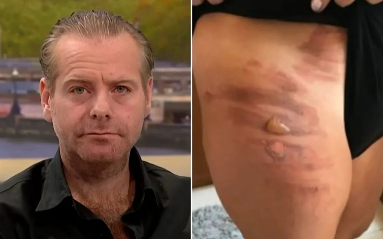 Brit, 41, suffered ‘life changing’ penis burns after coffee slipped off tray table as he fumes crew joked about it