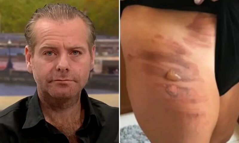 Brit, 41, suffered ‘life changing’ penis burns after coffee slipped off tray table as he fumes crew joked about it