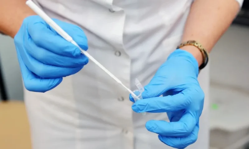 Urine cancer test that looks for ‘zombie cells’ years before symptoms could be available on NHS in 5 years
