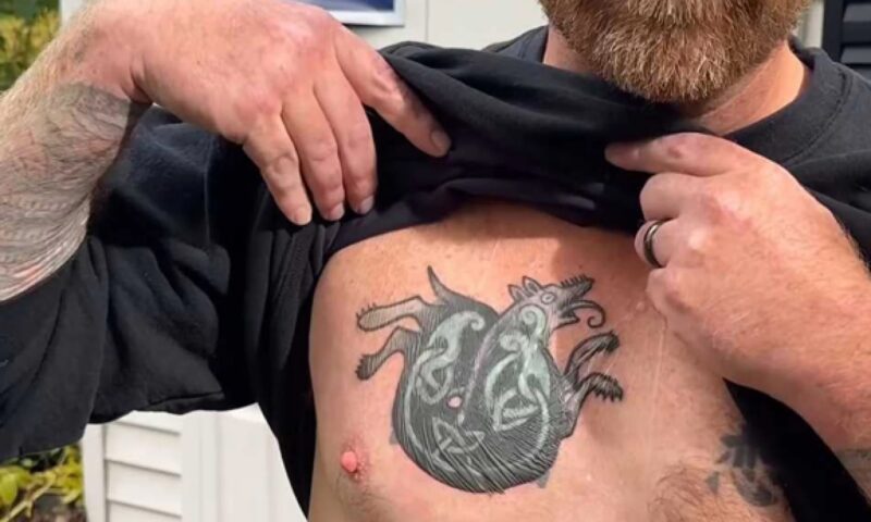 Jake Auchincloss ripped by Democrats for calling Senate hopeful Graham Platner’s Nazi tattoo ‘disqualifying’