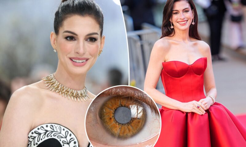 Anne Hathaway’s secret decade-long medical condition left her nearly blind throughout her 30s