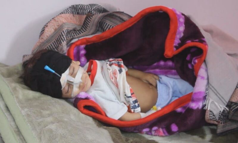 يونيسف: الأطفال الأكثر عرضة لخطر مخلفات الحرب في اليمن