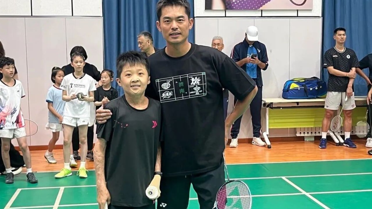China boy with 97% burns dreams of becoming top badminton player, practises daily despite pain