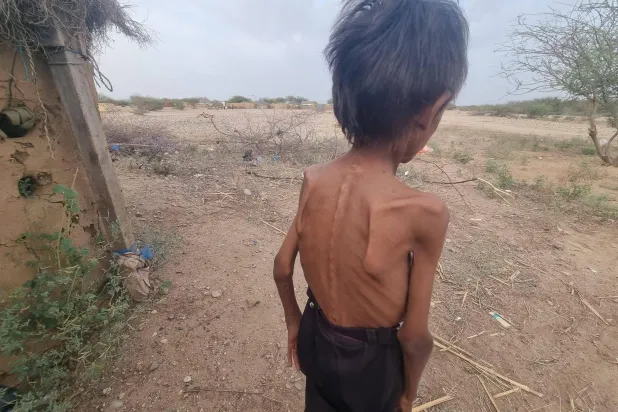 الجوع ينهش اليمن… والحوثيون يستخفون بالمأساة