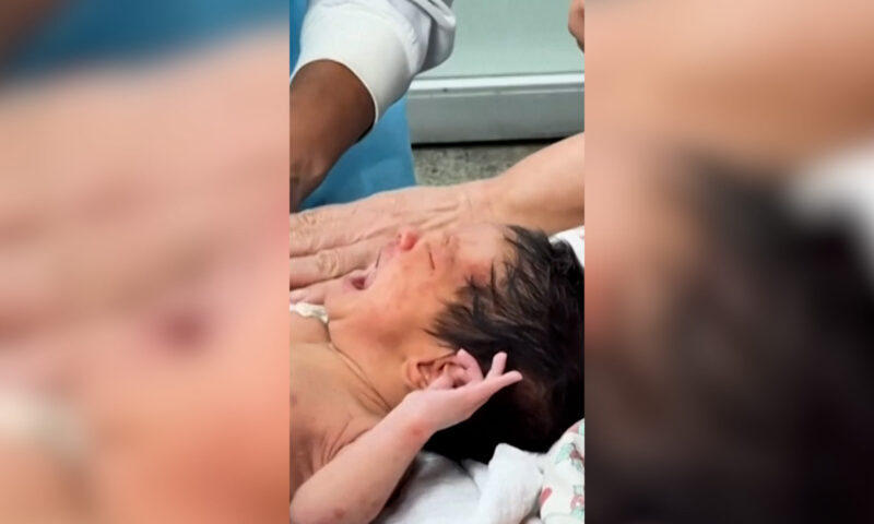 رضيع بعمر 18 يوماً ينجو بعد 32 ساعة تحت أنقاض زلزالي فنزويلا