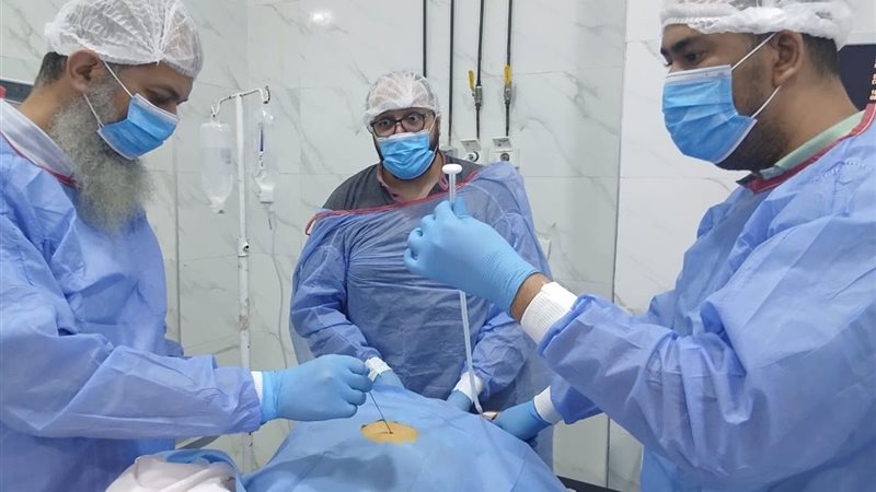 مناظير الجهاز الهضمي بفاقوس تنجح في تركيب أنبوب تغذية معدية لمسنة