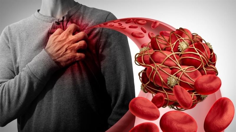 استشاري قلب يحذر: المتعافون من كورونا أكثر عرضة للإصابة بالجلطات