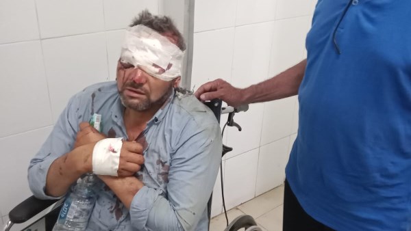 إصابة معلمين في حادث سير خلال توجههما لأعمال امتحانات الشهادة الإعدادية