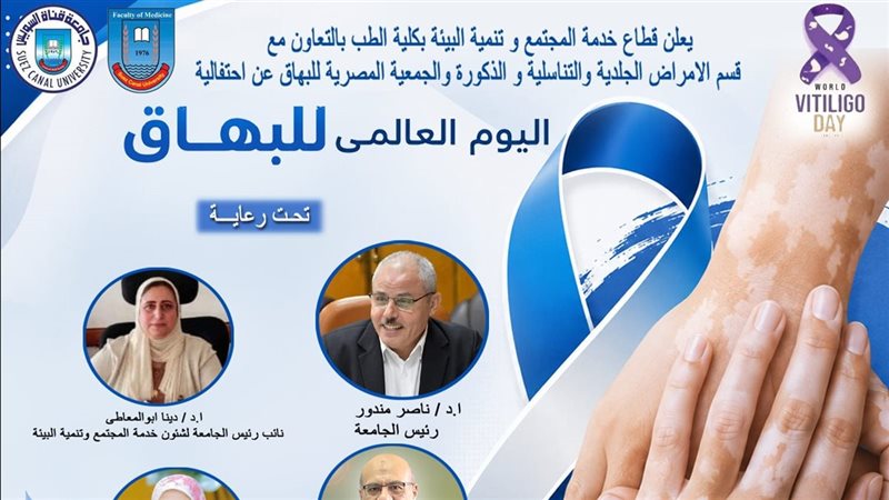 جامعة القناة تنظم احتفالية باليوم العالمي للبهاق لنشر الوعي ودعم المرضى