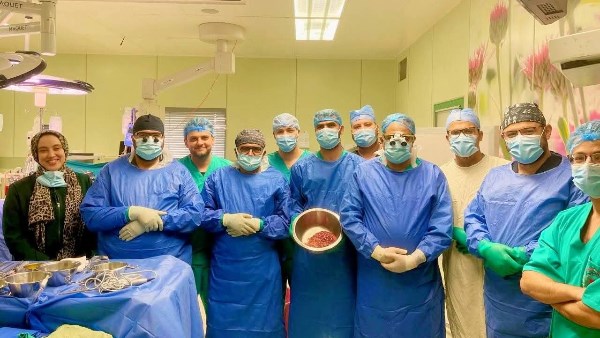 نجاح زراعة كبد لطفلة 13 عامًا بمعهد الكبد القومي خلال أقل من 48 ساعة في المنوفية