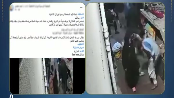 كسر ذراع الزوج وإتلاف كاميرات المنزل.. تفاصيل مشاجرة عنيفة بالدقهلية
