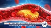 متى يكون ضيق التنفس مؤشرًا لارتفاع الكوليسترول؟.. علامات تحذيرية لا يجب تجاهلها