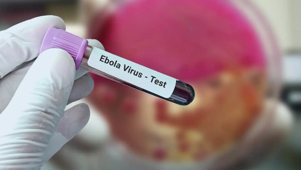 إيبولا والطيران.. كيف تتعامل السلطات الصحية مع الحالات المشتبه بها؟