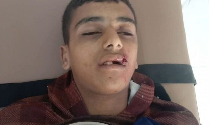 استشهاد صياد بنيران جيش الاحتلال وسط قطاع غزة