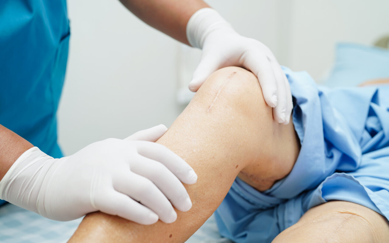 Alberta rolls out activity-based surgery funding model to more public hospitals